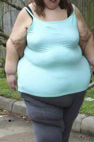 Mi vida con 300 kilos: qué pasó después. T(T6). Mi vida con 300... (T6): Lacey y Mercedes