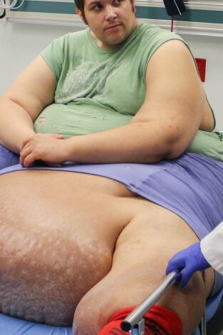 Mi vida con 300 kilos: qué pasó después. T(T9). Mi vida con 300... (T9): Ep.6