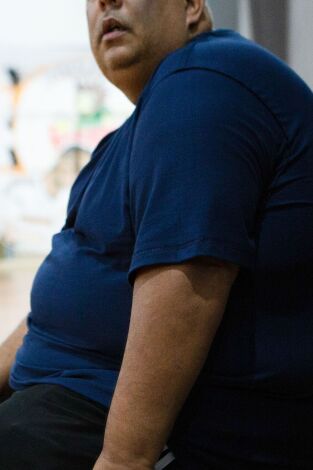Mi vida con 300 kilos: Brasil. T(T1). Mi vida con 300... (T1): Welton y Marcelo