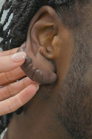 Dra Emma: Clínica dermatológica, Season 7. T(T7). Dra Emma: Clínica... (T7): Se lo oculté al mundo