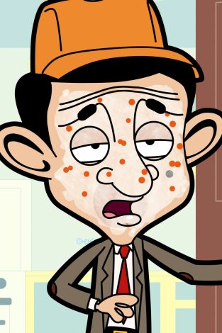 Mr. Bean, Season 4. T(T4). Mr. Bean, Season 4 (T4): Paciente de mentira