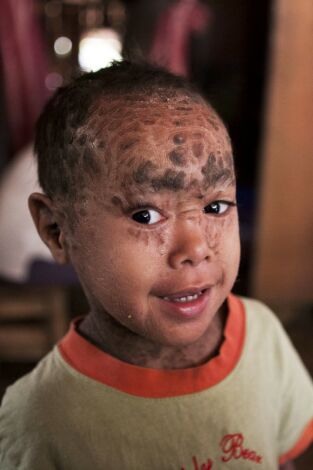 Diagnósticos extraordinarios. T(T8). Diagnósticos... (T8): La peor enfermedad del mundo