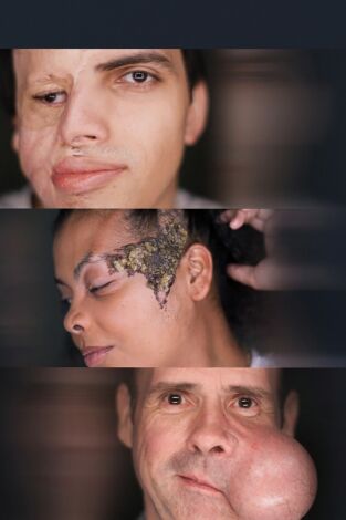 Reconstrucciones faciales. T(T1). Reconstrucciones... (T1): Ep.6 
