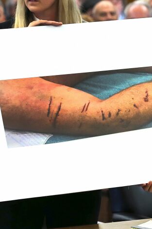 Un cuerpo en la nieve: el juicio de Karen Read. Un cuerpo en la nieve:...: Cuánto se tarda en morir de frío