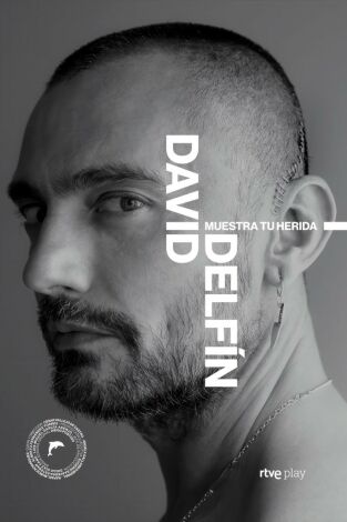 David Delfín. Muestra tu herida