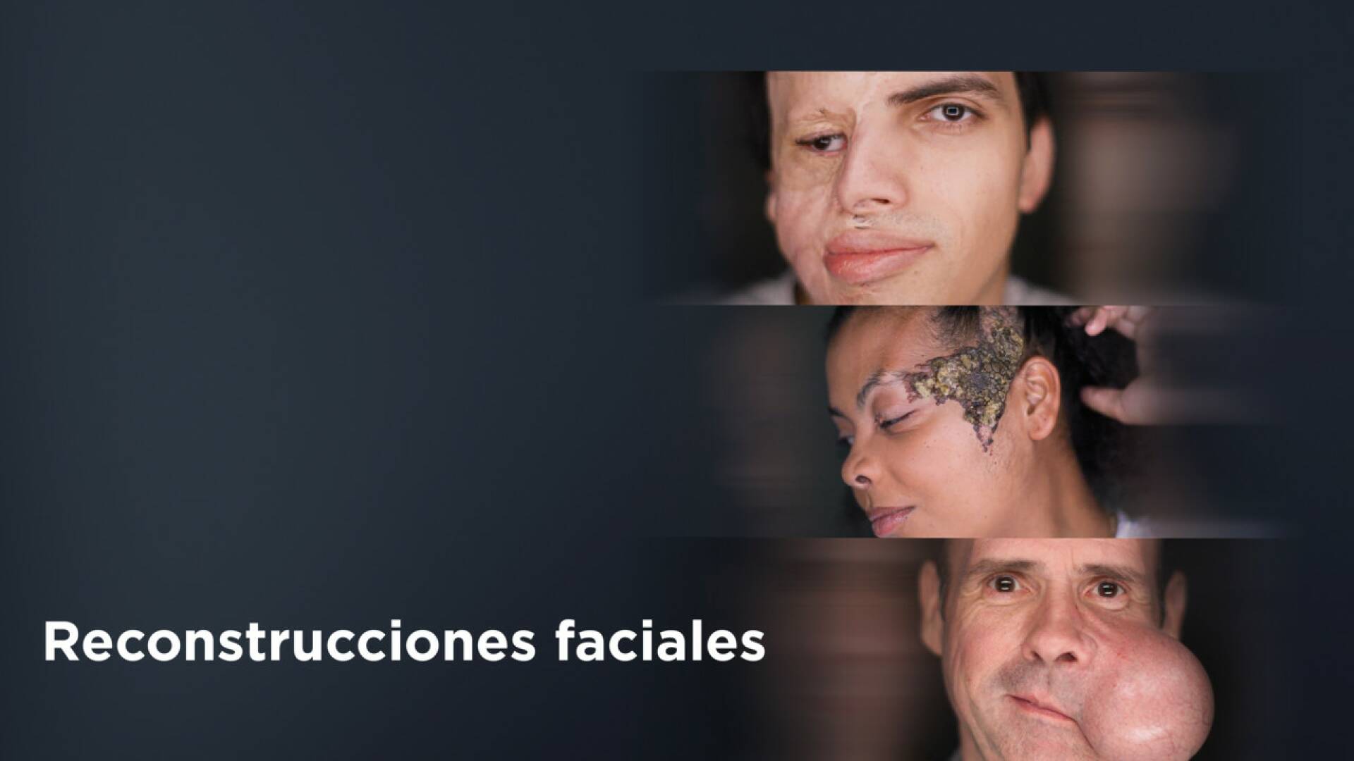 Reconstrucciones faciales