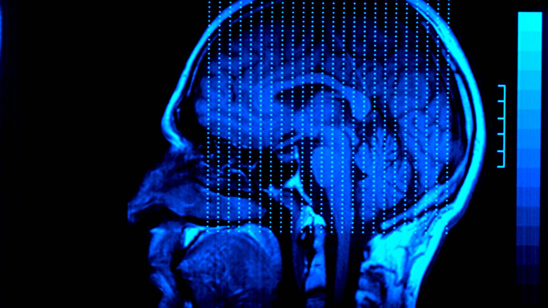 El cerebro de Caín 