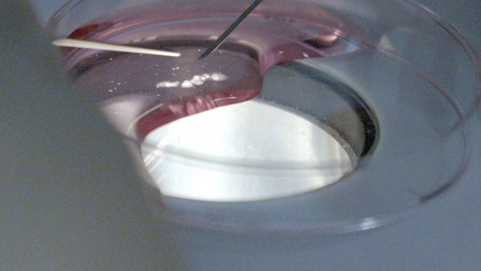 Congelar la fertilidad