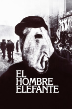 El hombre elefante