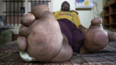 Imagen de Diagnósticos... (T3): Un tumor más grande que mi cabeza - 2
