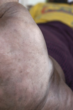 Imagen de Diagnósticos... (T3): Un tumor más grande que mi cabeza - 1