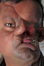Diagnósticos...: Un tigre se comío mi rostro