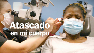 Imagen de Atascado en mi cuerpo  - 2