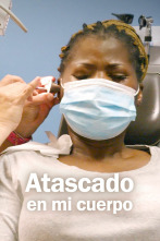 Imagen de Atascado en mi cuerpo  - 1