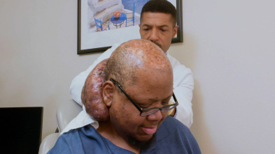 Imagen de Tumores extremos: El hombre del tumor picante - 2