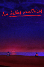 Imagen de Las bellas cicatrices - 1
