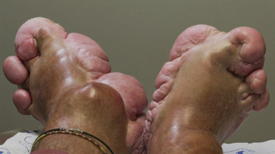 Imagen de Los pies me están... (T1): Ep.10 - 2