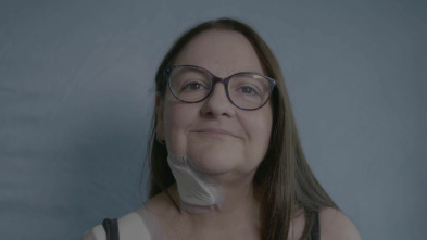 Imagen de Cirugía facial: Un agujero en el rostro - 2