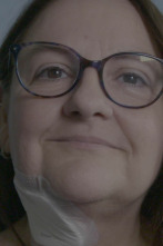 Imagen de Cirugía facial: Un agujero en el rostro - 1