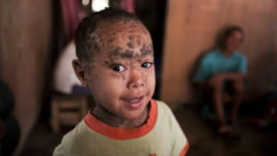 Imagen de Diagnósticos... (T8): La peor enfermedad del mundo - 5