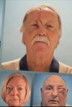 Imagen de Cirugía Facial (T1): Ep.8 - 4