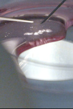 Imagen de Congelar la fertilidad - 4