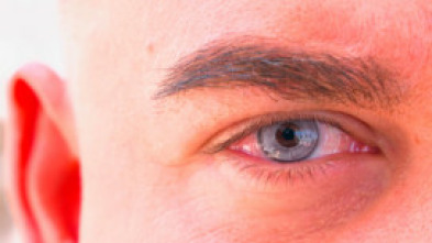 Imagen de Focus  - 5