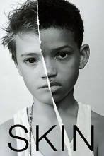 Imagen de Skin - 2