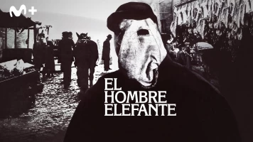 El hombre elefante