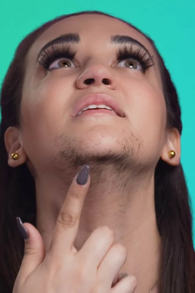 Bad Hair Day. Bad Hair Day: Barbie con psoriasis