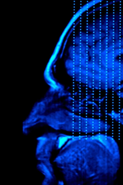 El cerebro de Caín