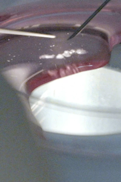 Congelar la fertilidad